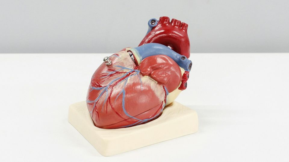 Anatomical heart model showing major blood vessels and coronary arteries.