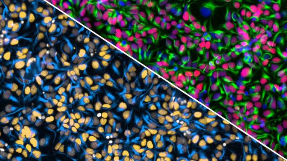 Fluorescence microscopy image comparing human stem cells with different cellular markers and nuclei staining.