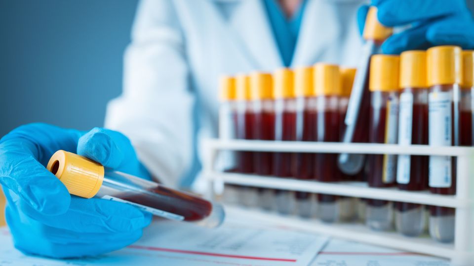 Gloved hand of a scientist holding a blood collection cube next to a rack holding several tubes.