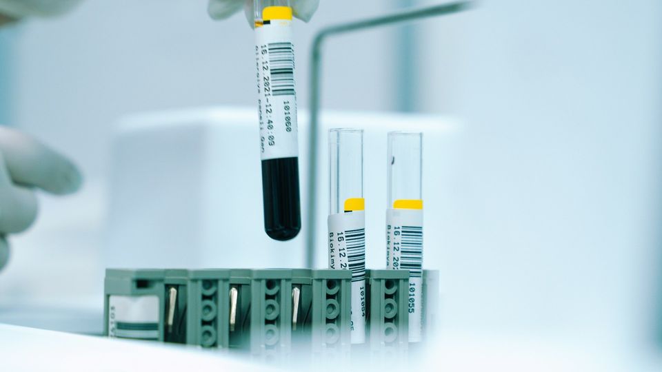 Blood-filled test tube being placed into a laboratory rack next to two other test tubes.