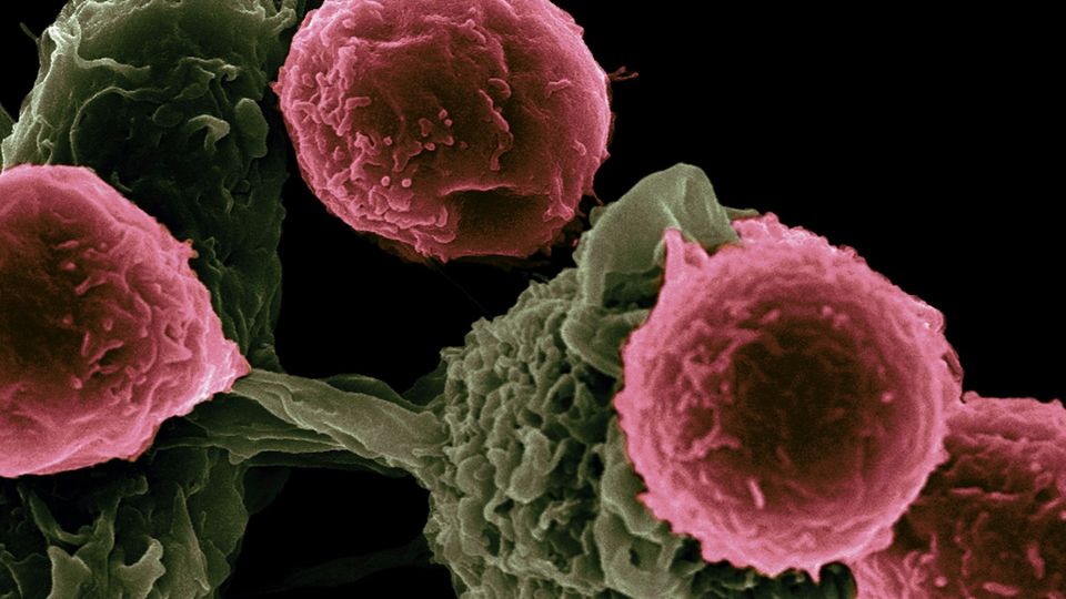 Colored electron microscope image of immune cells interacting with target cells.
