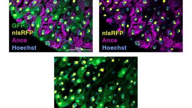 Fluorescence microscopy of gut epithelial cells showing GFP and nuclear markers. 