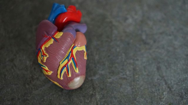 Anatomical heart model showing the major blood vessels and coronary arteries. 