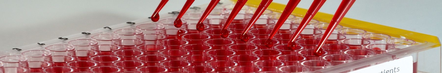Scientific background with pipettes 