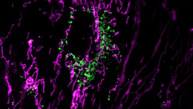 Fluorescent microscopy image showing mitochondria highlighted in green and magenta. 