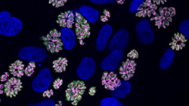 Fluorescence microscopy image showing green and magenta Toxoplasma parasites among blue-stained cells. 