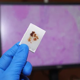 FFPE sample prep with a tissue specimen held for microscopic analysis.