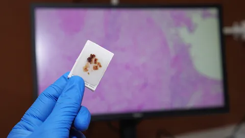 FFPE sample prep with a tissue specimen held for microscopic analysis.