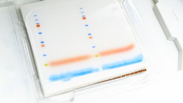 A western blot experiment readout. 