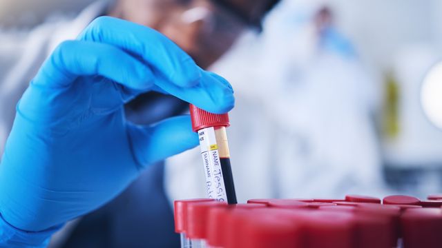 A scientist holding up a test tube containing a blood sample. 