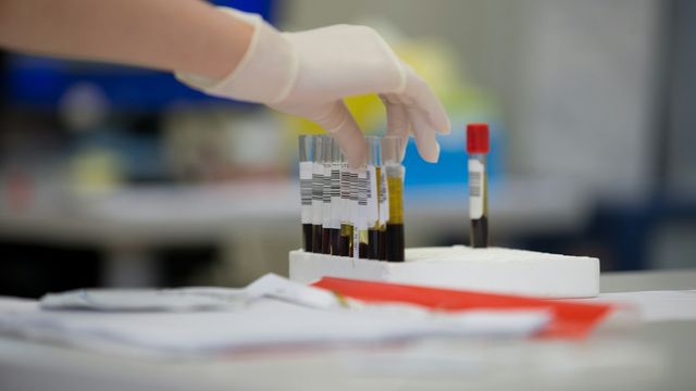 Blood sample tubes with labeled barcodes in a laboratory rack. 