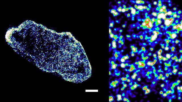 An image of a glowing cell taken under a microscope, made up of thousands of glowing white and blue dots. 
