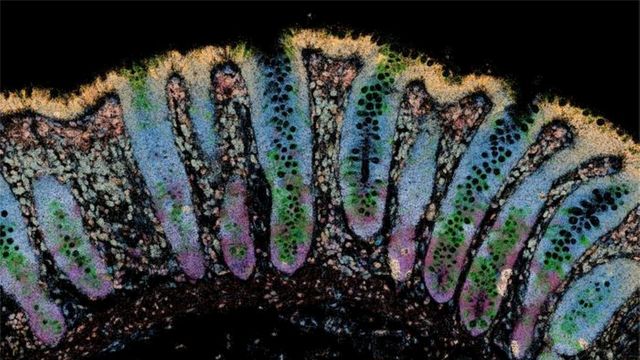 Microscopic image of intestinal tissue with densely packed cells. 