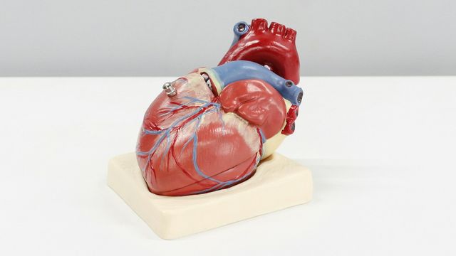 A model of a human heart showing chambers and blood vessels on a white surface. 