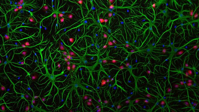Fluorescent microscopy showing astrocytes and cell nuclei. 