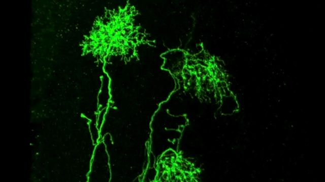 Fluorescent microscopy showing branching neurons with bright green structures against a dark background. 