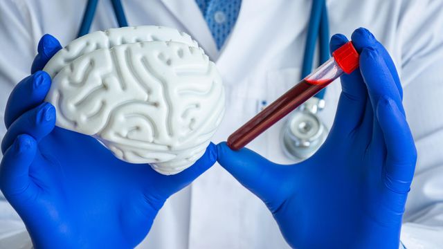 Gloved hands holding up a white brain model and a test tube filled with blood. 