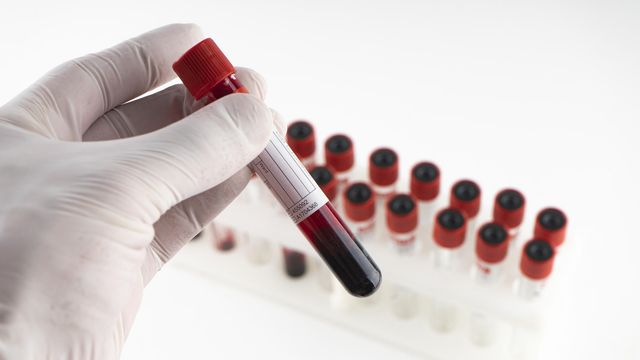 Gloved hand removing a test tube containing blood from a rack of samples. 