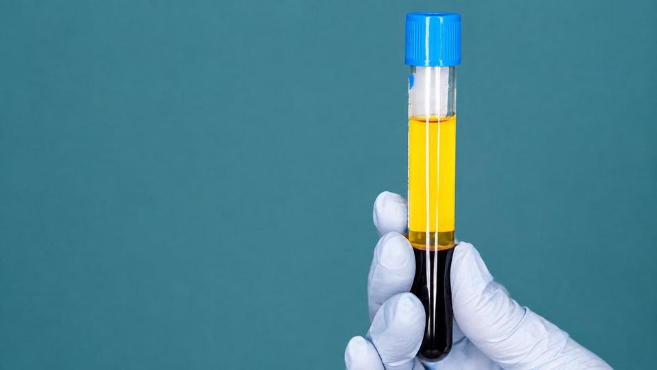 Streamline Multi-Targeted Steroidomics Workflows | Technology Networks