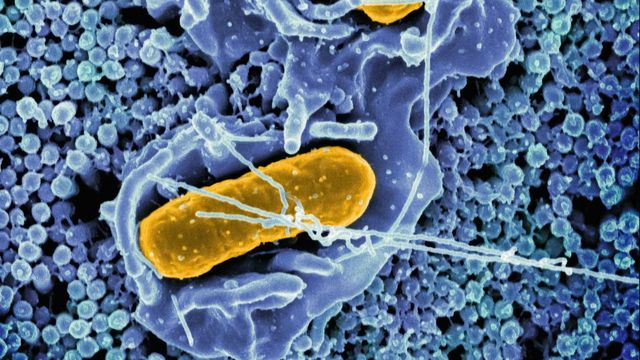 Salmonella Typhimurium bacteria shown in a microscopic view. 