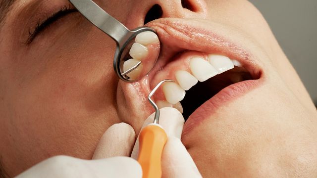 https://assets.technologynetworks.com/production/dynamic/images/content/416856/woman-dentist-caroline-lm-unsplash-640x360.jpg?cb=20260925