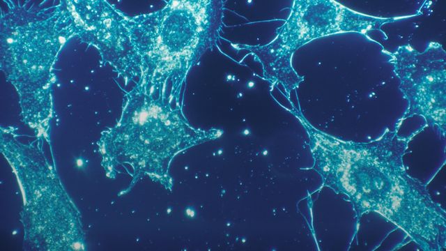 Fluorescent blue cells with irregular shapes against a dark background. 