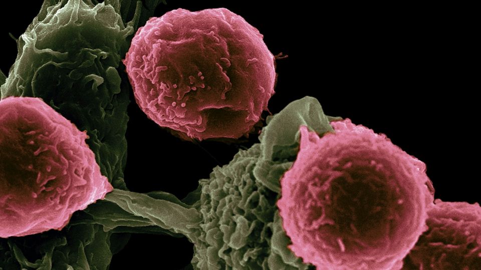 Microscopic view of cancer cells interacting with immune system cells.