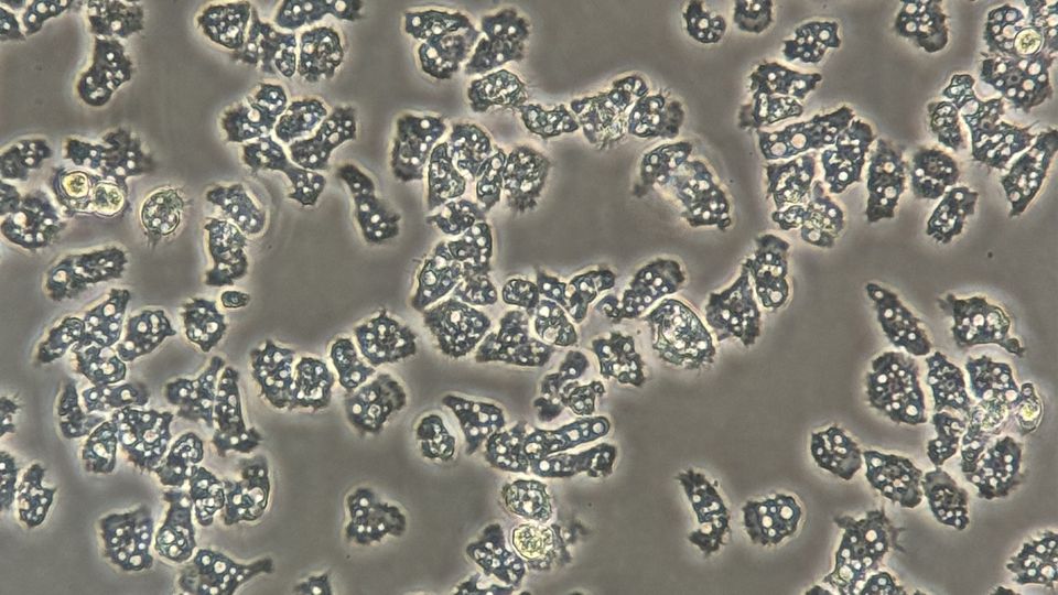 Microscope image of Acanthamoeba.