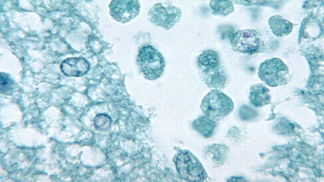 Photo: technologynetworks.com Brain tissue phil